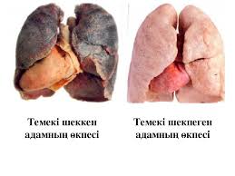 Темекіден жыл сайын 8 млн адам көз жұмады