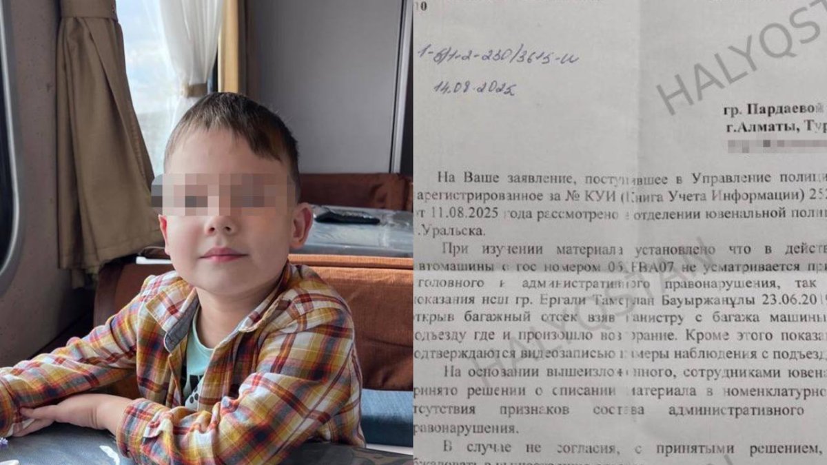 «Баламды әдейі күйдірді»: Оралда 8 жастағы бала 96% күйіктен көз жұмды