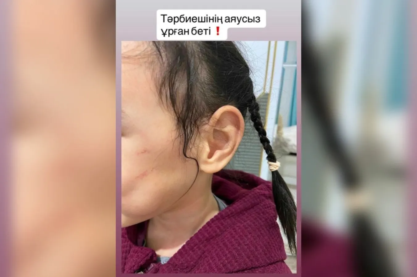 Астанада балабақшада бала жарақат алды: ата-ана қызметкерді айыптады